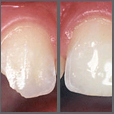 Rehabilitación oral y prótesis