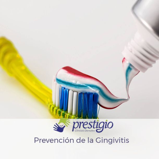 Prevención de la gingivitis