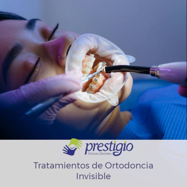 Cuida tu tramiento de ortodoncia con brackets en Prestigio Dental, Clínicas en Parla y Valdemoro