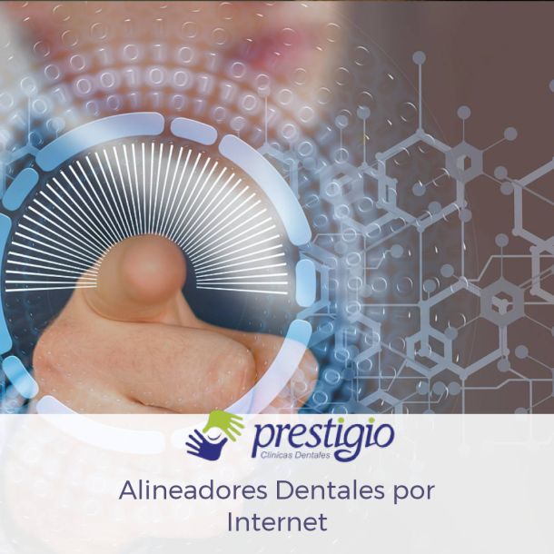 Alineadores dentales por Internet