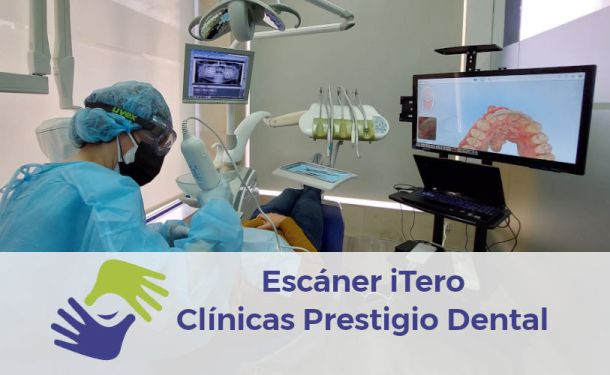 Escáner iTero en Clínica Dental Prestigio: tecnología de vanguardia